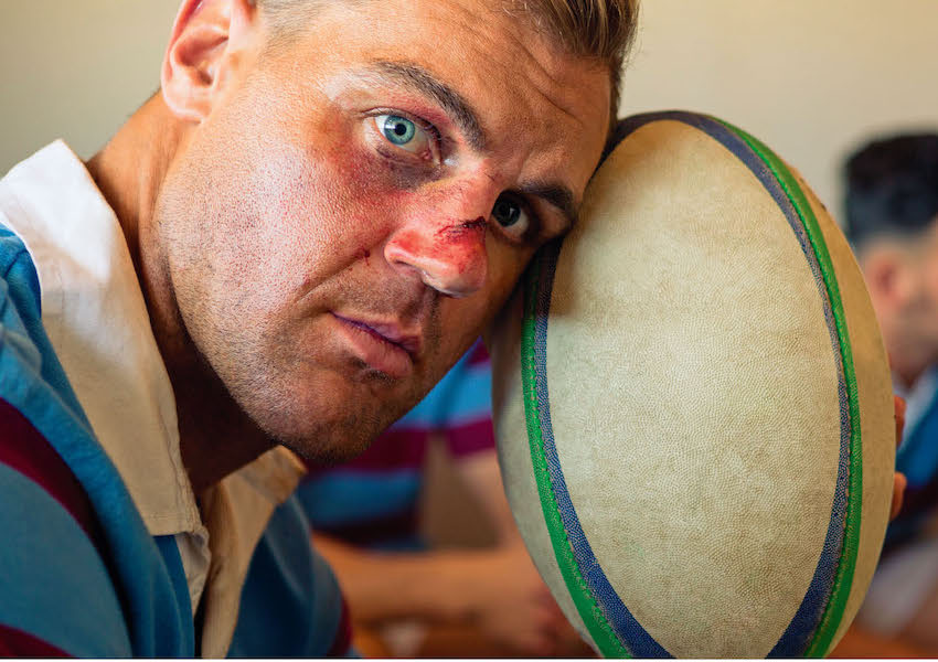 Image Le rugby est-il devenu un sport à risque ?