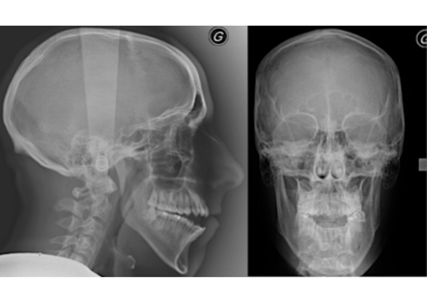 Image DES RADIOGRAPHIES FACE À ALZHEIMER