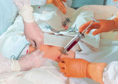 Image SIDA : BIENTÔT GUÉRIR DU VIH ?