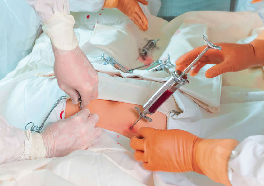 Image SIDA : BIENTÔT GUÉRIR DU VIH ?