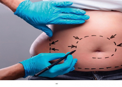 Image CHIRURGIE ESTHÉTIQUE, CHIRURGIE ÉTHIQUE ?